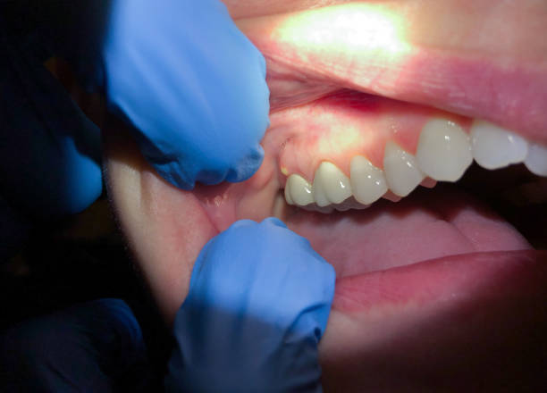 Best Emergency Cosmetic Dentistry (e.g., broken veneers) in Crafton, PA