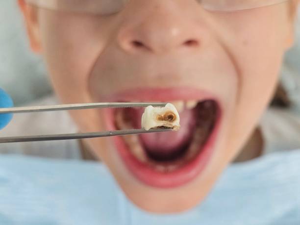 Best Emergency Dental Care for Sports Injuries in Crafton, PA